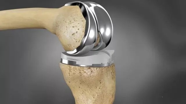 Biocompatible Titanium Rods: Medical-Grade Implants for Spinal & Orthopedic Use