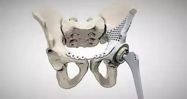 Biocompatible Titanium Rods: Medical-Grade Implants for Spinal & Orthopedic Use